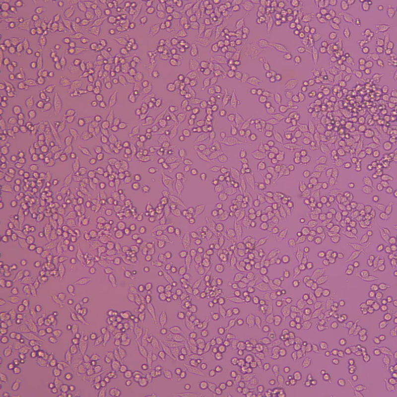 MiaPaCa-2（人胰腺癌细胞）