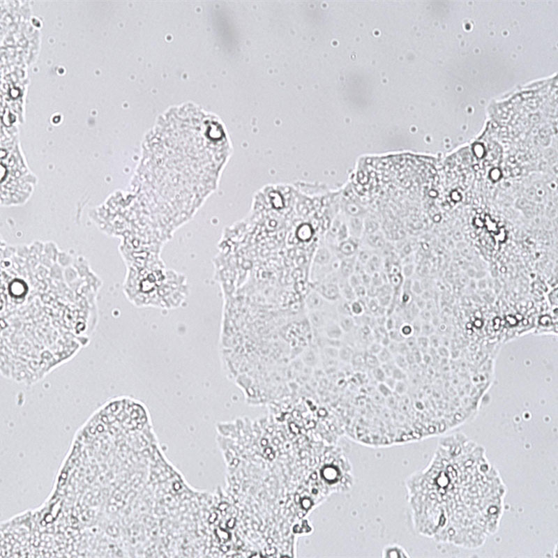 NCI-N87 [N87]（人胃癌细胞）