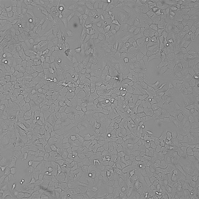 SK-OV-3（人卵巢癌细胞）