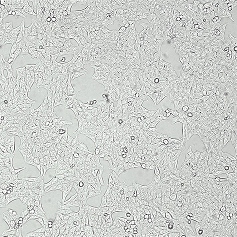 Hep 3B2.1-7（人肝癌细胞）