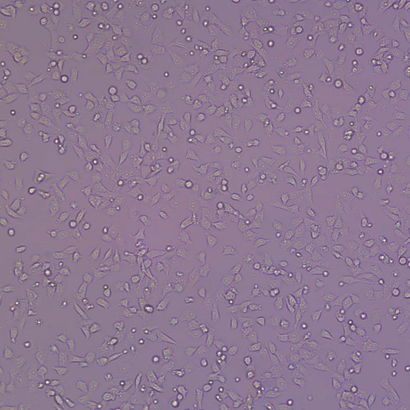 SK-NEP-1（人肾母细胞瘤细胞）