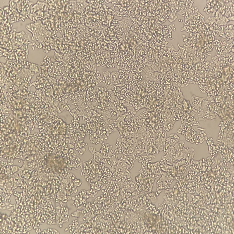 LS 174T（人结肠腺癌细胞）