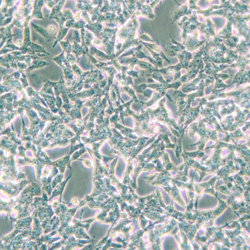 SK-N-BE(2)-C（人神经母细胞瘤细胞）