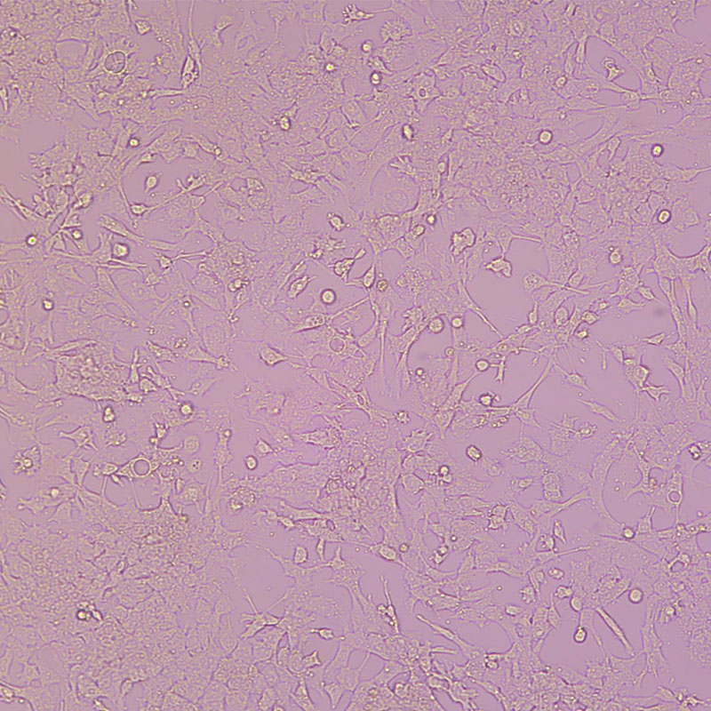 GL261（小鼠胶质瘤细胞）