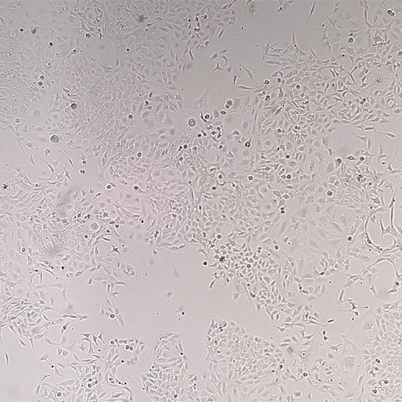 BALB/3T3 clone A31（小鼠胚胎成纤维细胞）