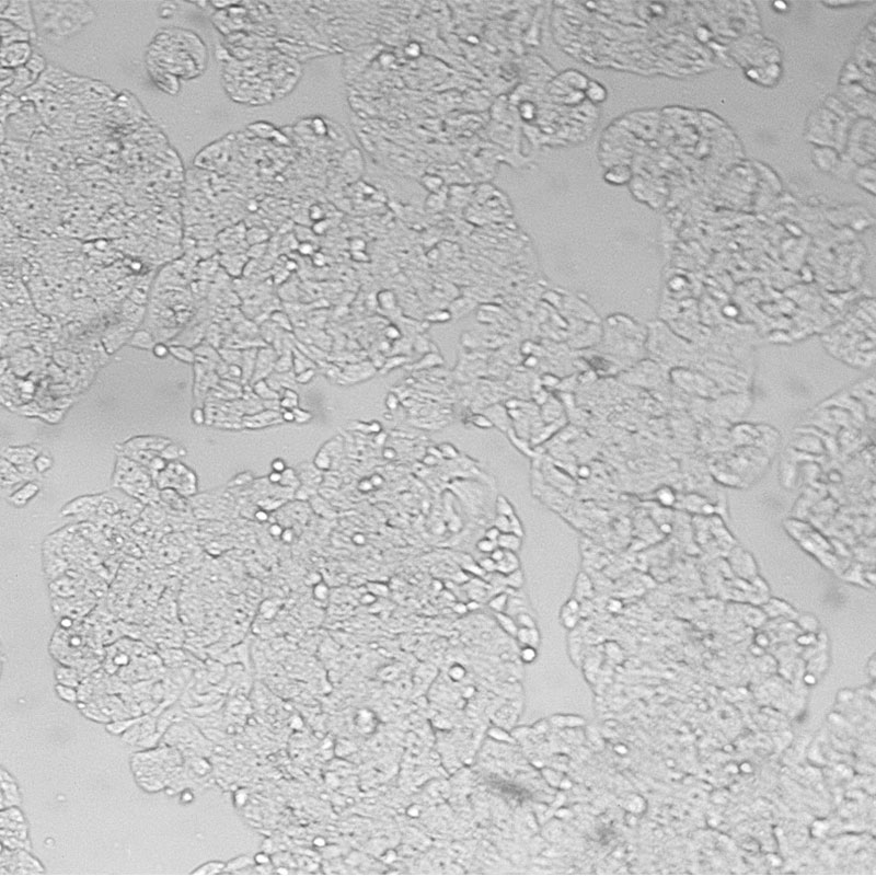 Caco-2（人结直肠腺癌细胞）