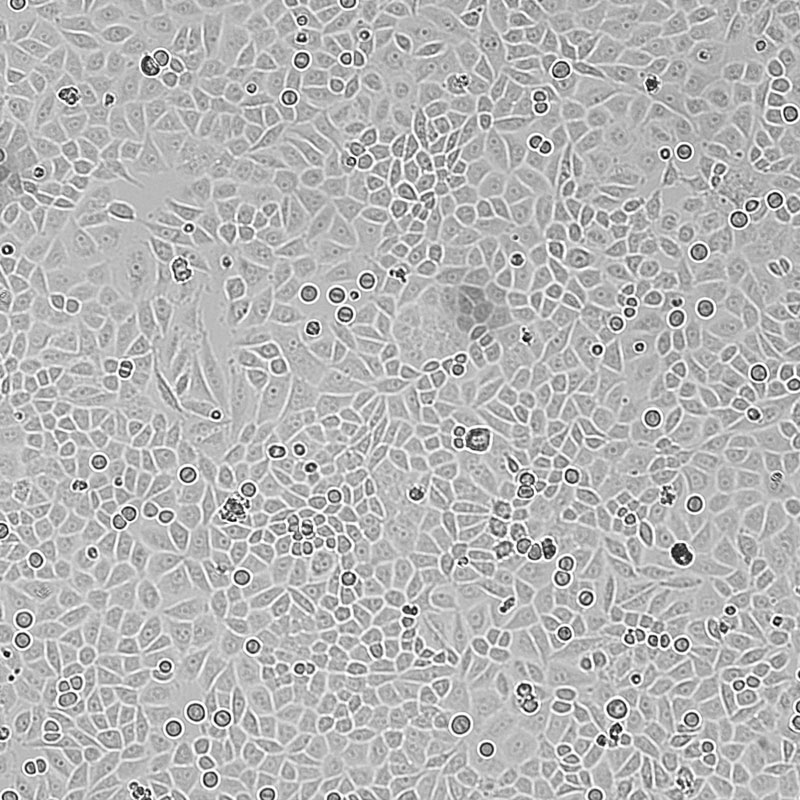 SiHa（人子宫颈鳞癌细胞）