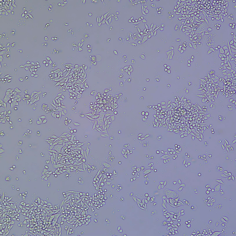 MDA-MB-231（人乳腺癌细胞）