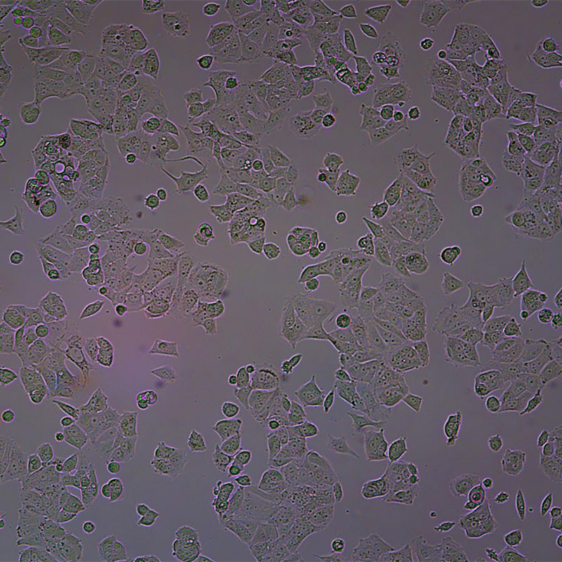 MCF7人乳腺癌细胞