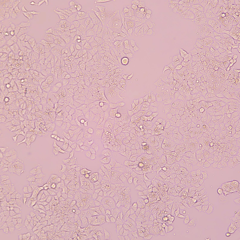 T-47D人乳腺管癌细胞