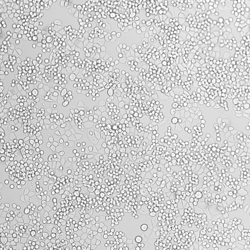 MDA-MB-453（人乳腺癌细胞）