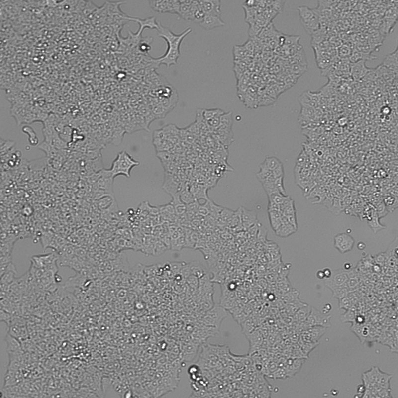 BT-474人乳腺导管癌细胞