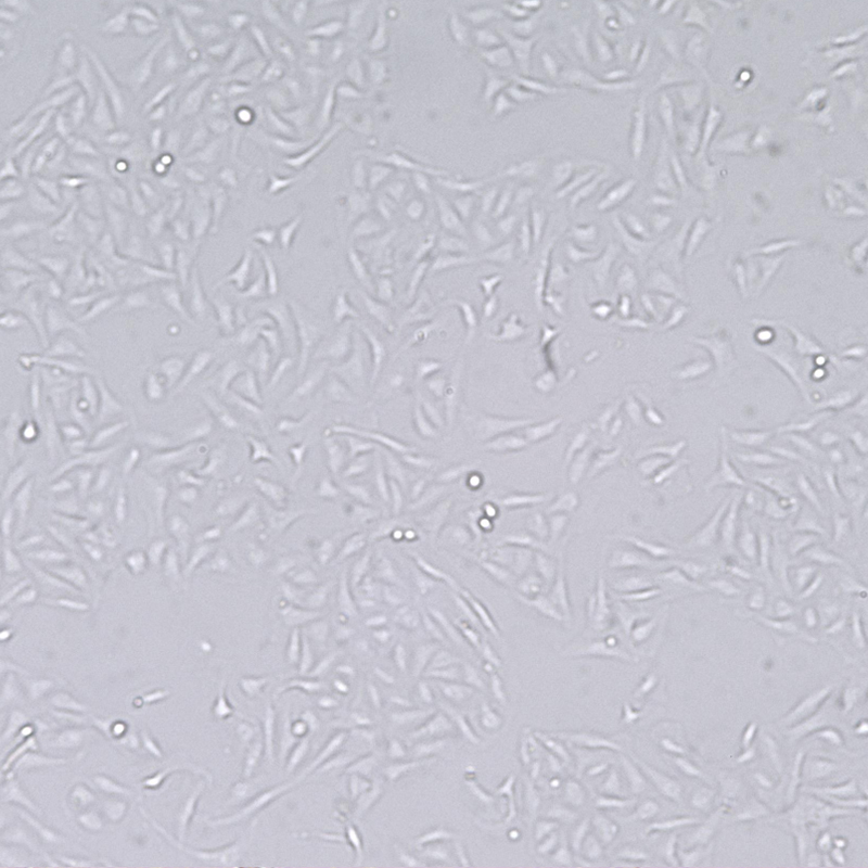 U2OS人骨肉瘤细胞