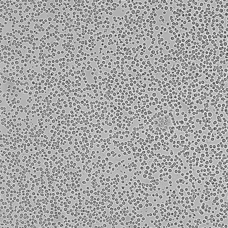 人急性T淋巴细胞白血病细胞