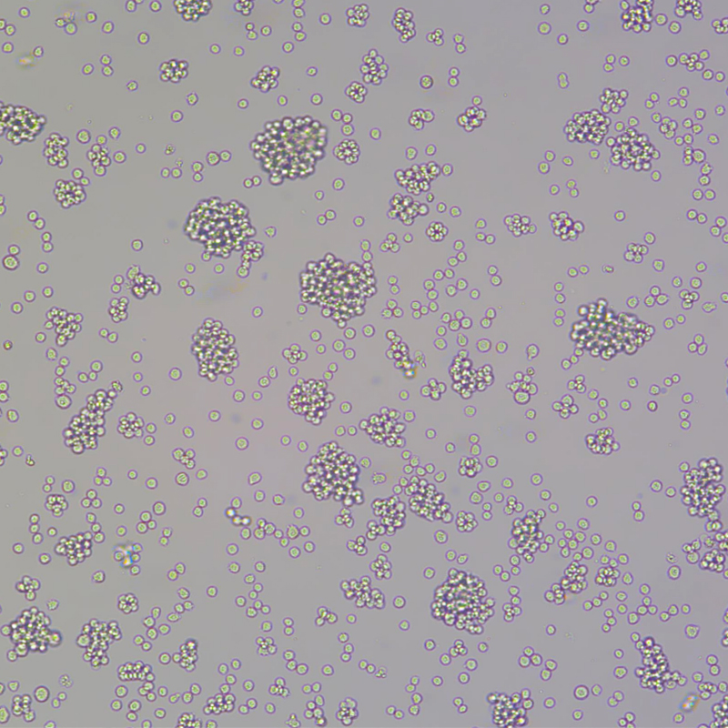 人Burkitt's淋巴瘤细胞