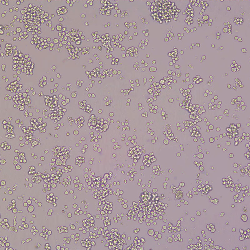 人单核细胞白血病细胞