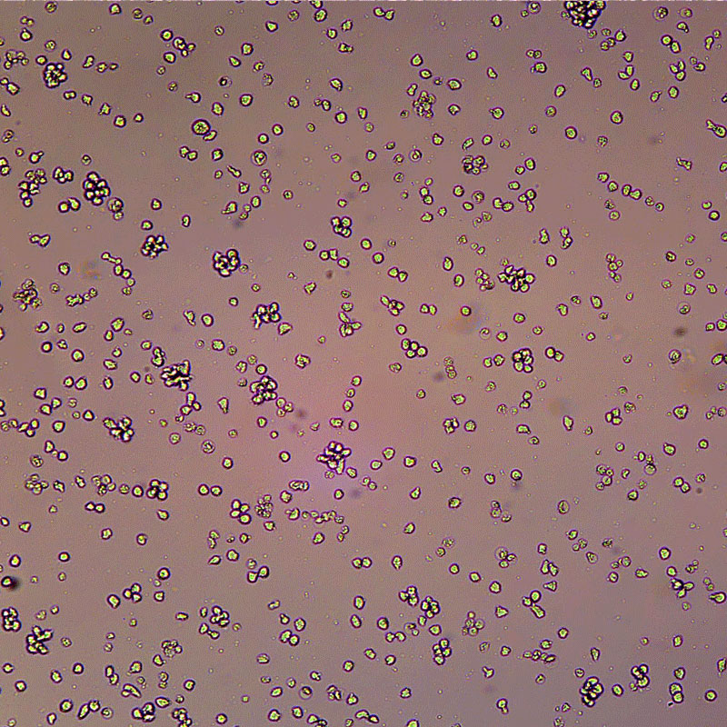人急性T淋巴细胞白血病细胞