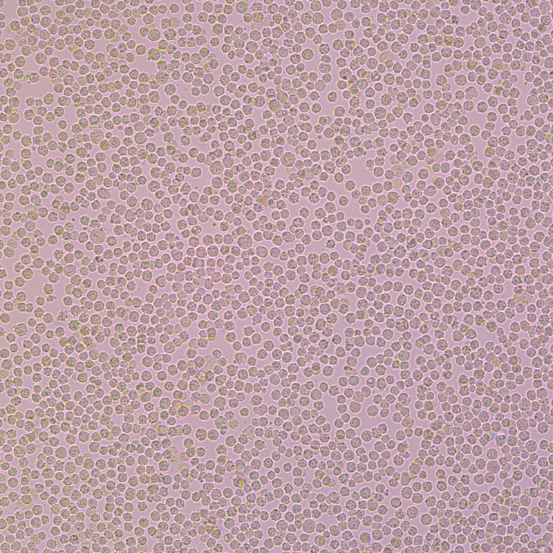 人慢性髓原白血病细胞