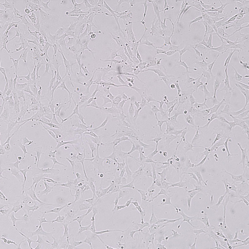 TB 1 LU（蝙蝠肺细胞）