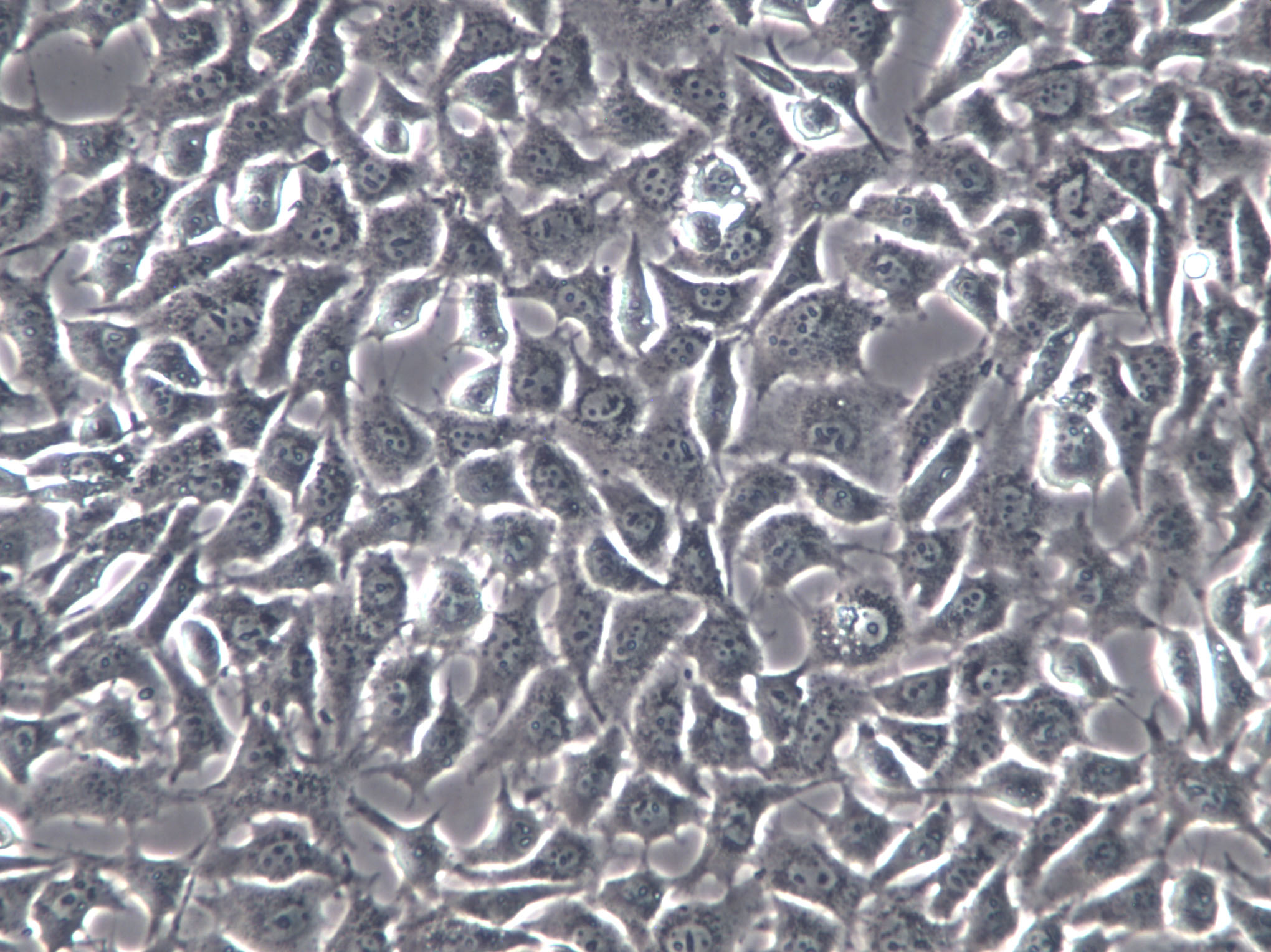 C-28/I2 Cells(赠送Str鉴定报告)|人正常软骨细胞