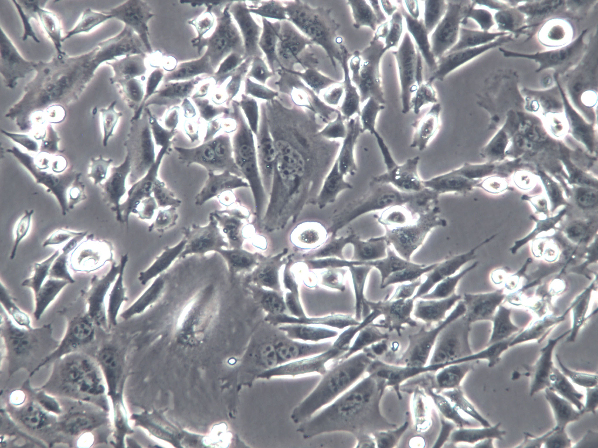 BAEC Cells(赠送Str鉴定报告)|牛主动脉内皮细胞