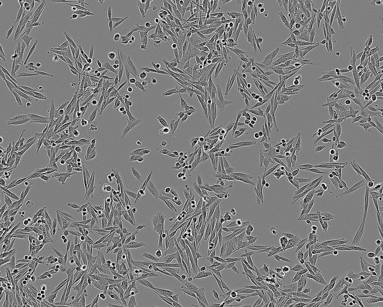 TCam-2 Cells(赠送Str鉴定报告)|人睾丸精原细胞瘤细胞