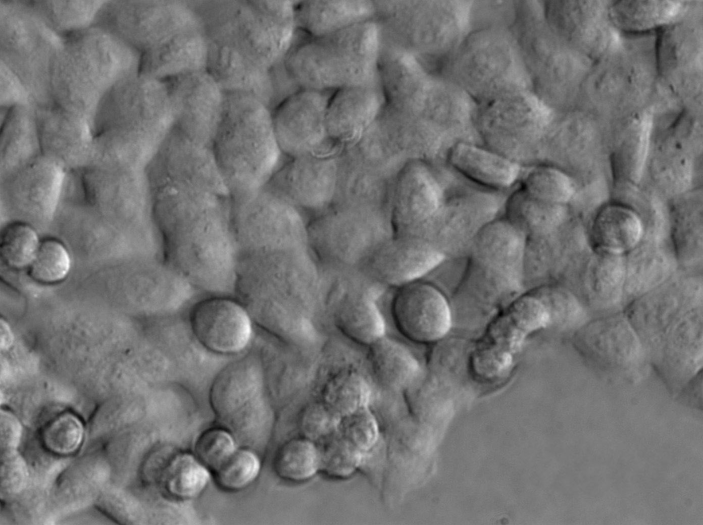 UM-UC-1 Cells|人膀胱移行癌克隆细胞
