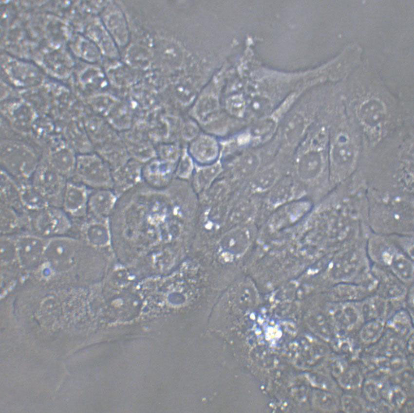COLO 699 Cells|人肺癌腺癌克隆细胞