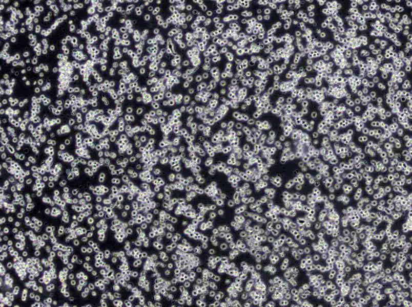 HuT 102 Cells|人T淋巴瘤克隆细胞