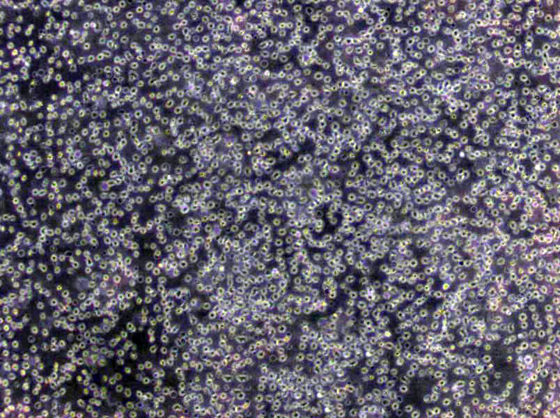 Karpas-422 Cells|人类B细胞淋巴瘤克隆细胞