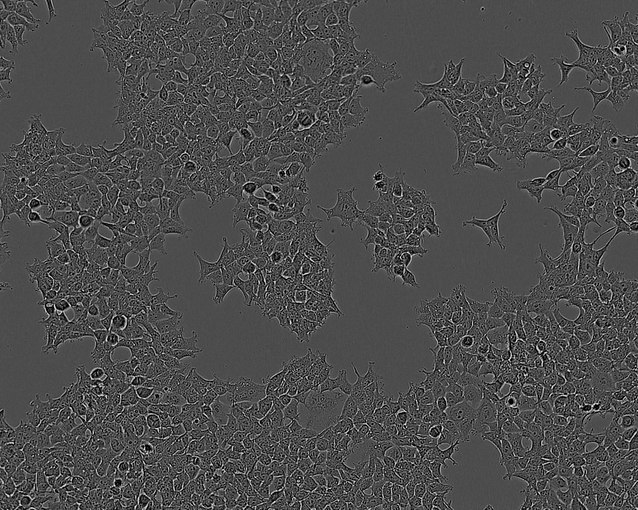 CAL-27 Cells|人舌鳞状上皮细胞癌可传代细胞系