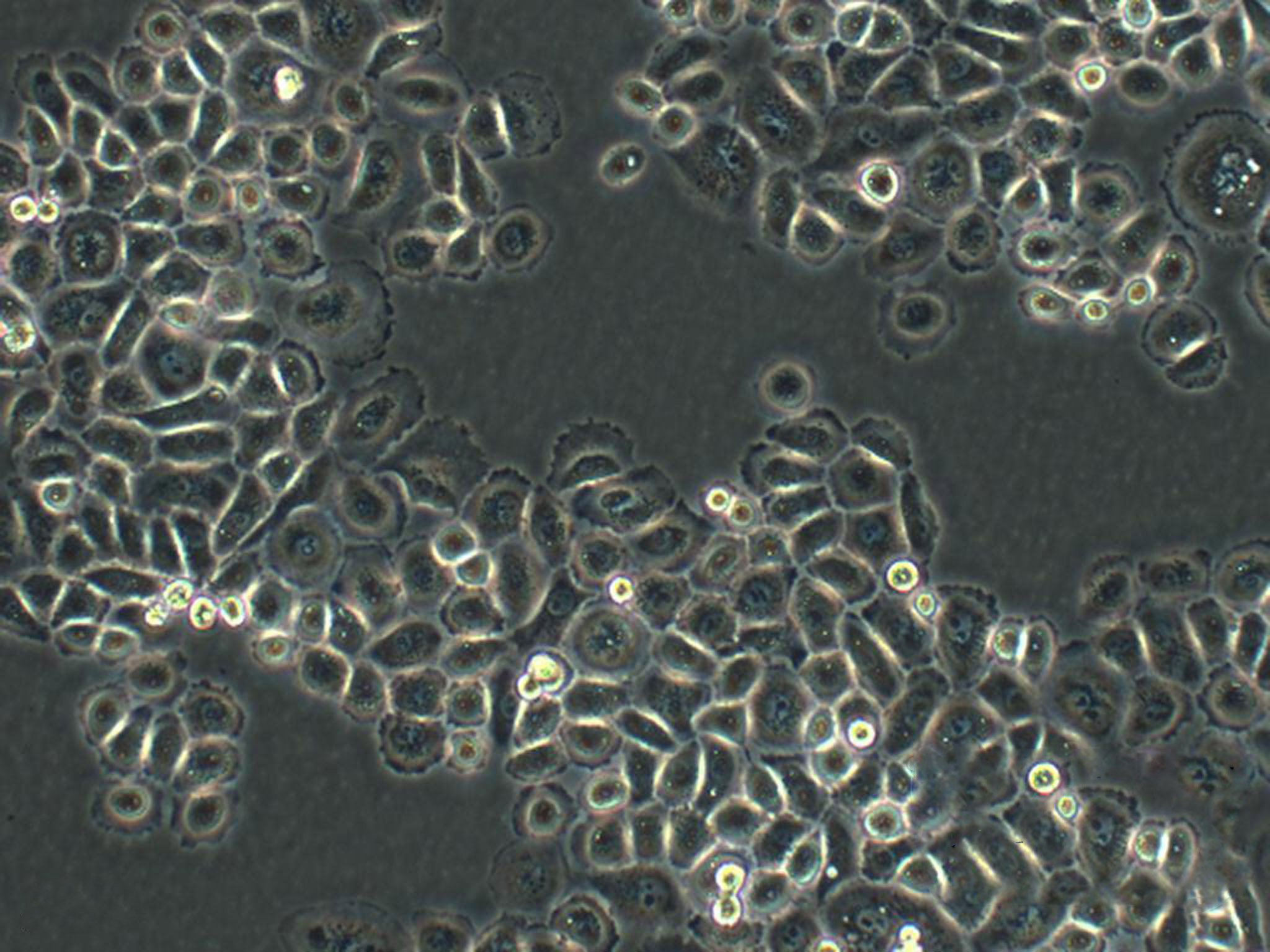MDA-MB-436 Cells|人乳腺癌可传代细胞系