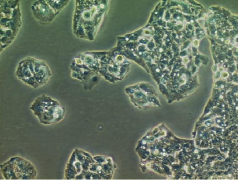 SNU-739 Cells(赠送Str鉴定报告)|人肝癌细胞