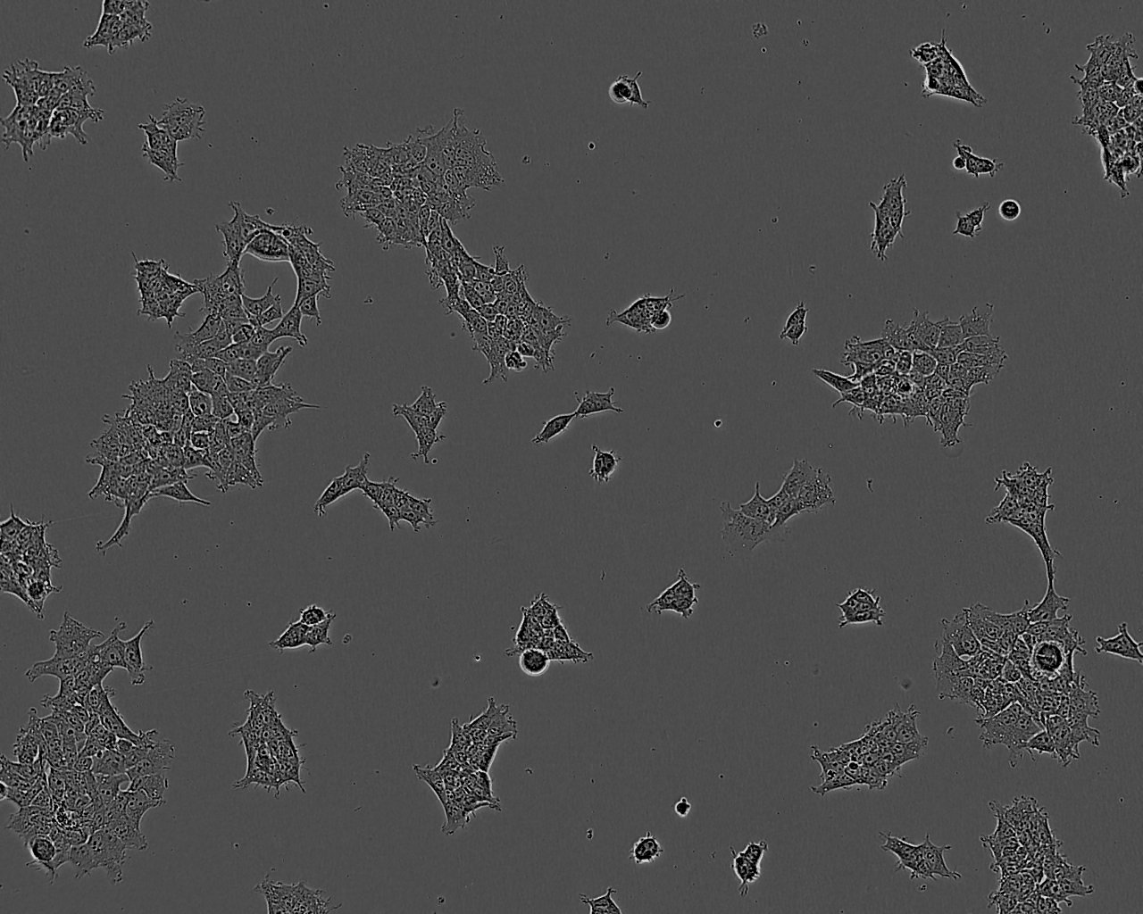 NIT-1 Cells(赠送Str鉴定报告)|小鼠胰腺β细胞