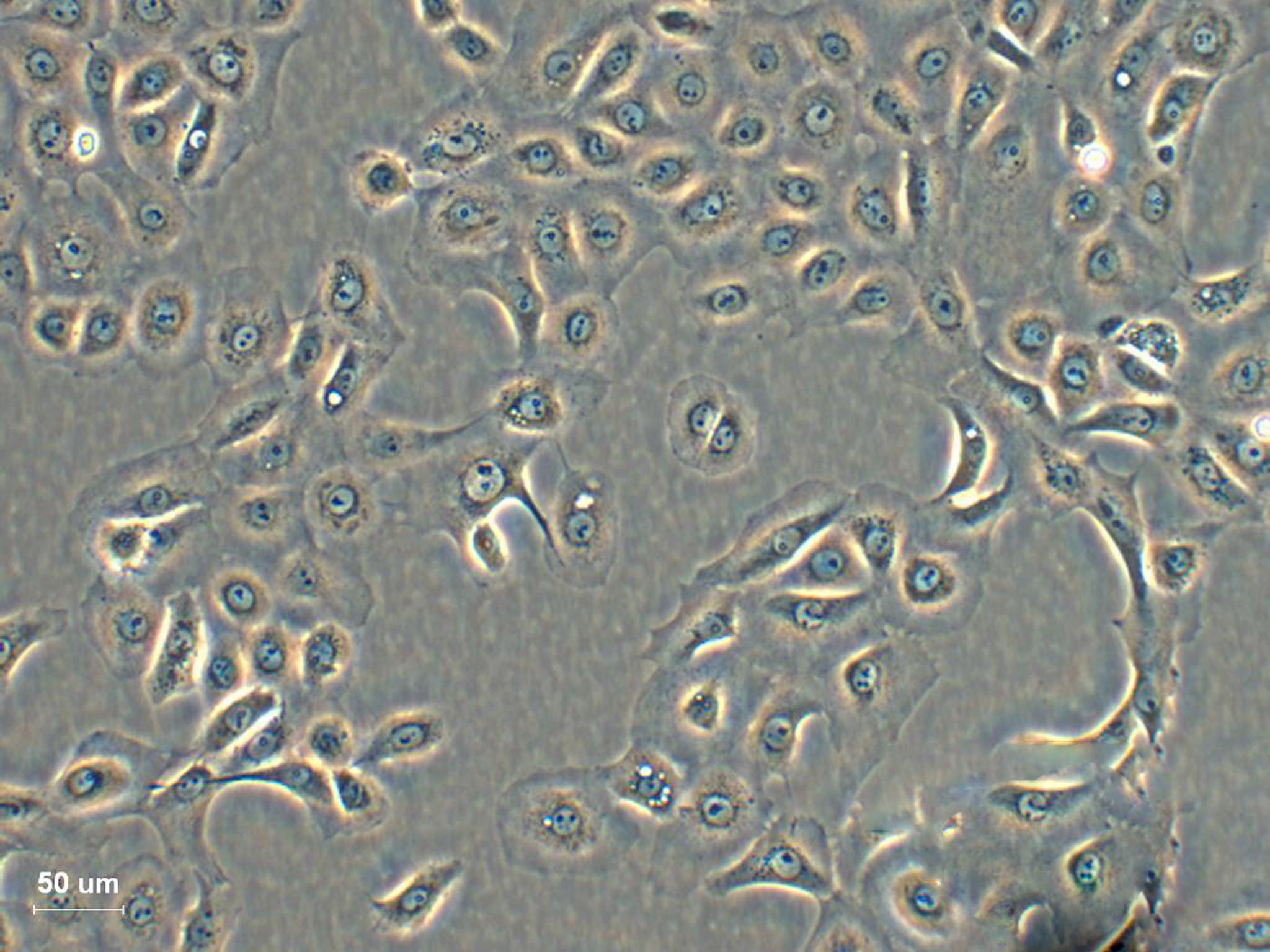 NCI-H510 Cells|人小细胞肺癌可传代细胞系