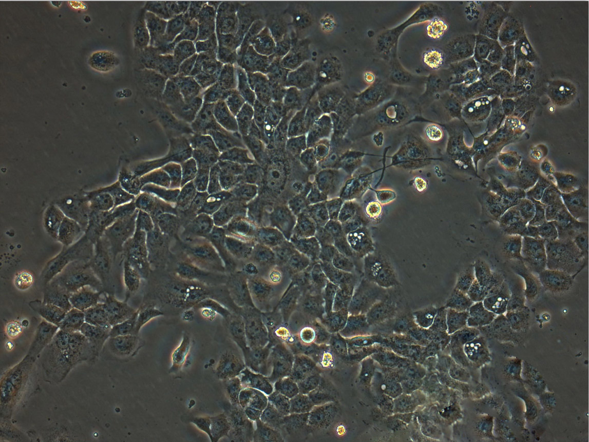 NCI-H889 Cells|人肺癌可传代细胞系