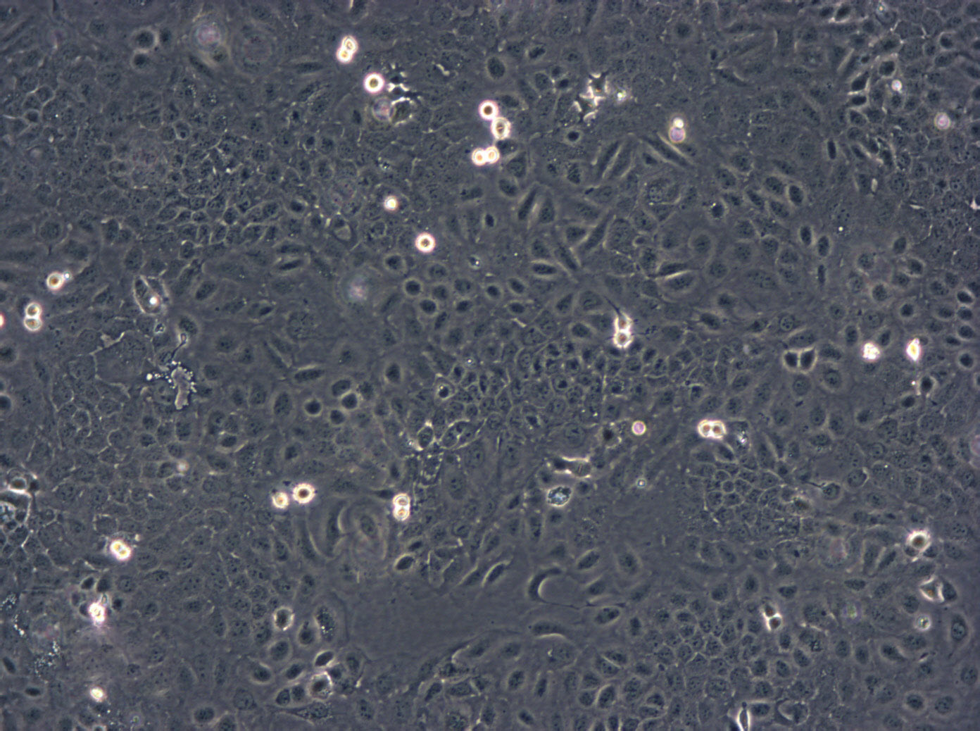 NCI-H2107 Cells|人小细胞肺癌可传代细胞系
