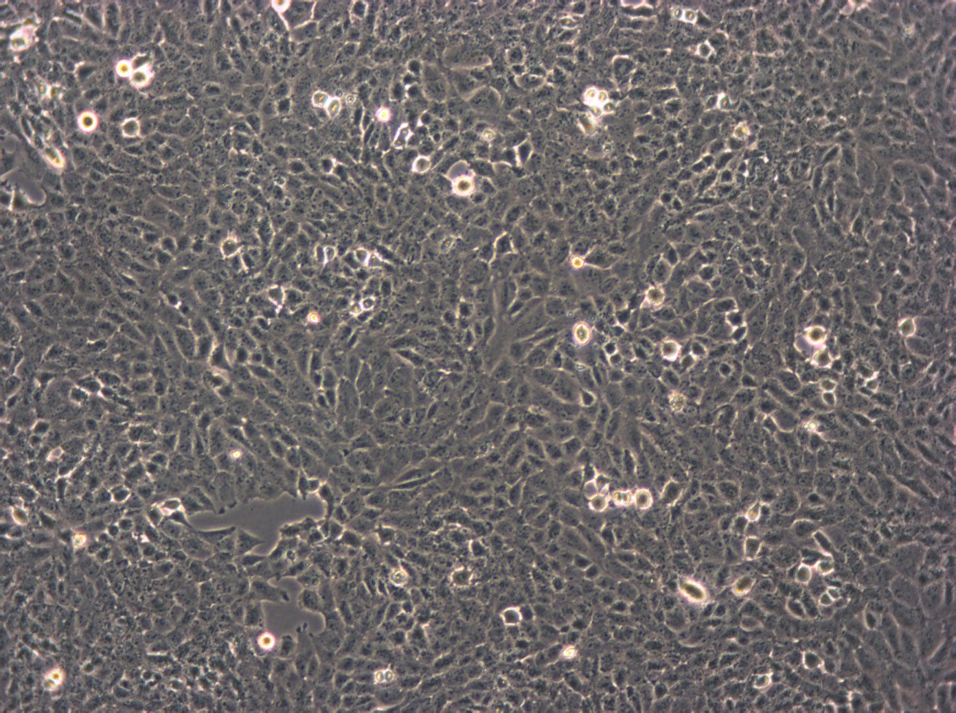 Lu-99A Cells(赠送Str鉴定报告)|人大细胞肺癌细胞