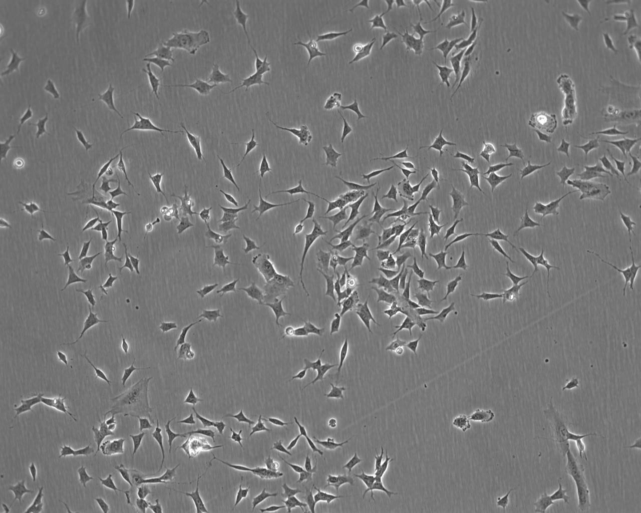 HO-1-N-1 Cells(赠送Str鉴定报告)|人鳞状上皮细胞癌细胞