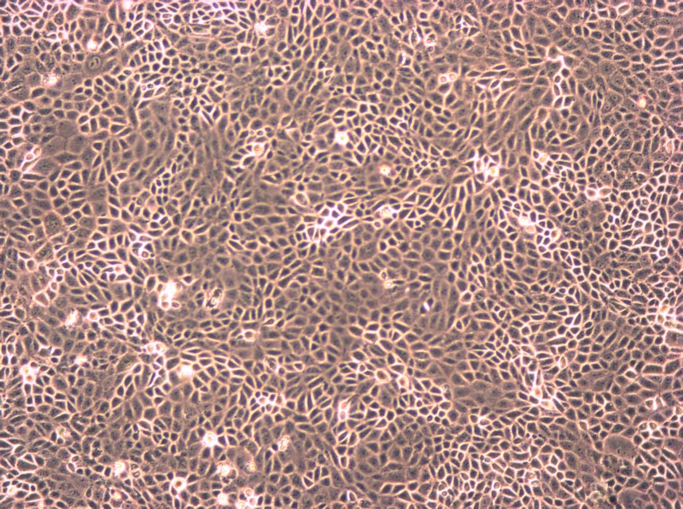 Hs 852.T Cells