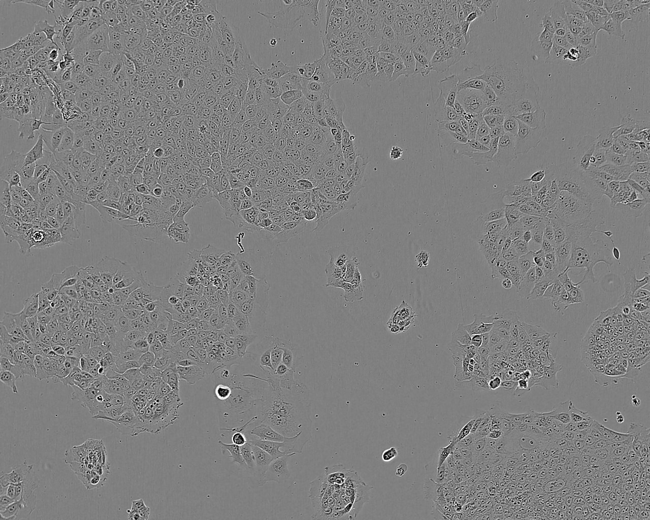 SK-MEL-28 Cells(赠送Str鉴定报告)|人恶性黑色素瘤细胞