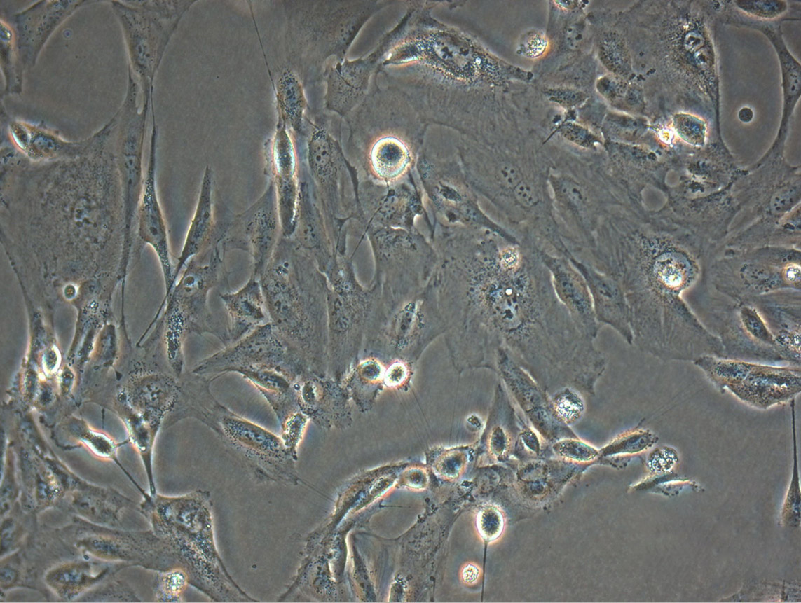 Hs 895.T Cells