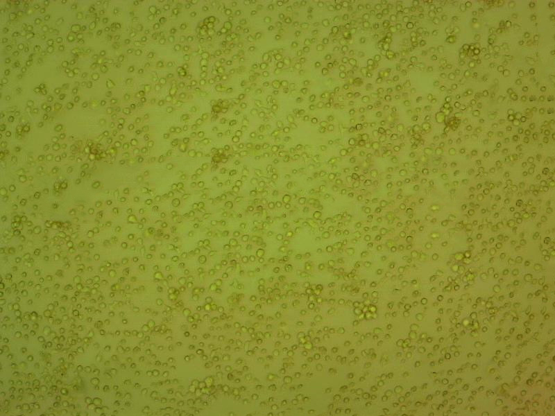 UT-7 Cells|人类原巨核细胞型白血病可传代细胞系