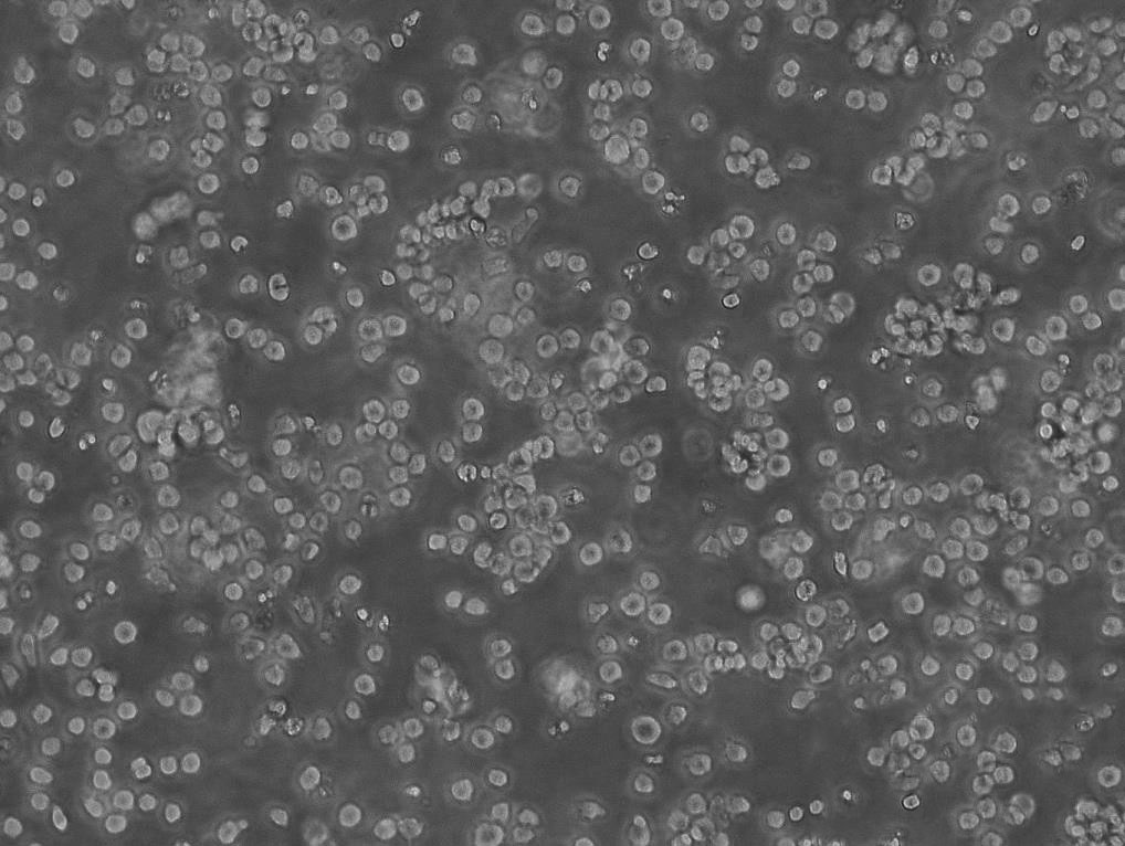 Karpas-422 Cells|人类B细胞淋巴瘤可传代细胞系