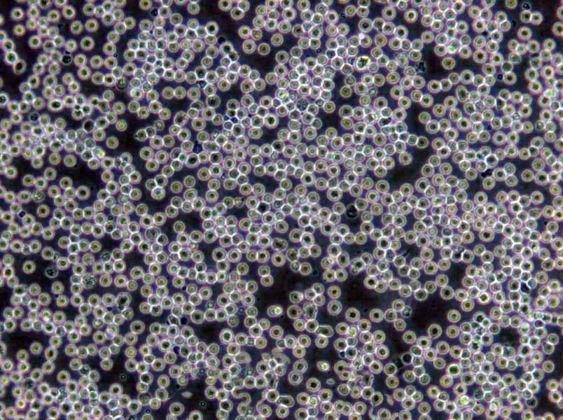 NCI-H1618 Cells(赠送Str鉴定报告)|人小细胞肺癌细胞
