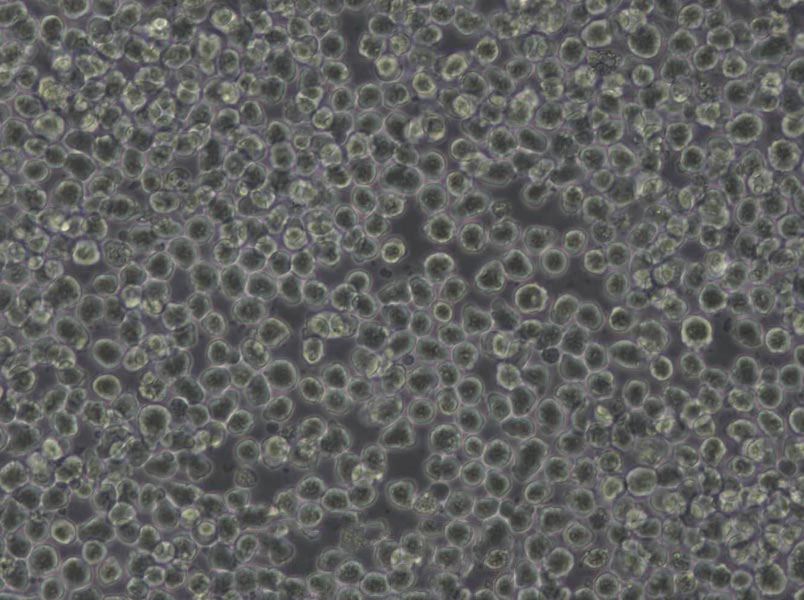 MDA-PCa-2b Cells|前列腺癌需消化细胞系