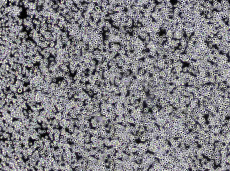 SK-MEL-1 Cells|皮肤黑色素瘤需消化细胞系