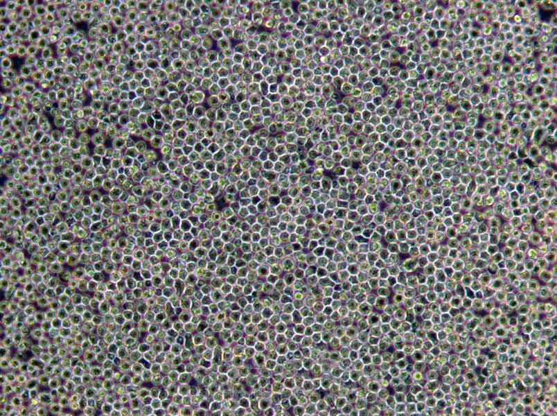 KYSE-520 Cells|食管鳞癌需消化细胞系