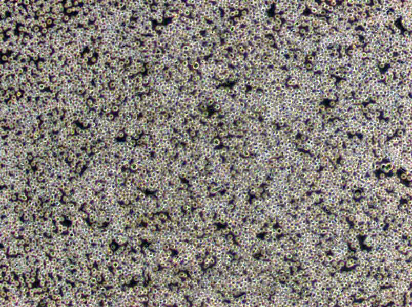 NuTu-19 Cells|大鼠卵巢癌需消化细胞系