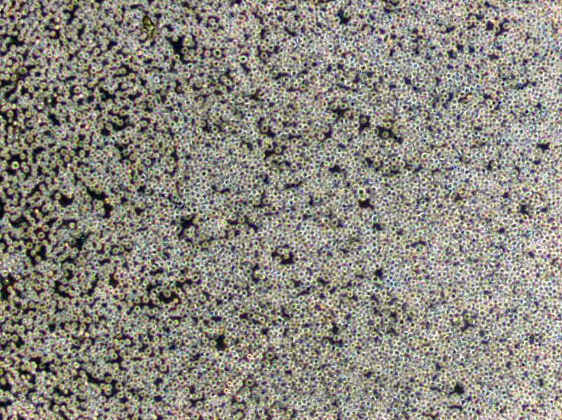 NUGC-4 Cells|胃癌需消化细胞系